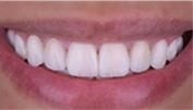 Close Up Smile