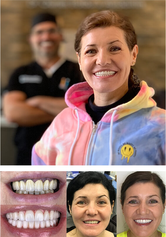 Success Story Teeth-in-1-Day