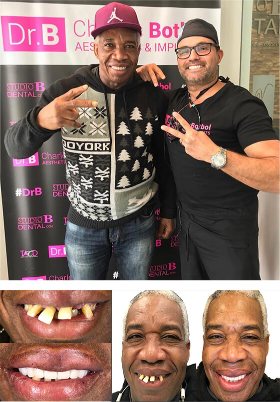 Success Story Teeth-in-1-Day